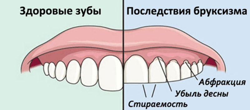 скрипить вночі зубами